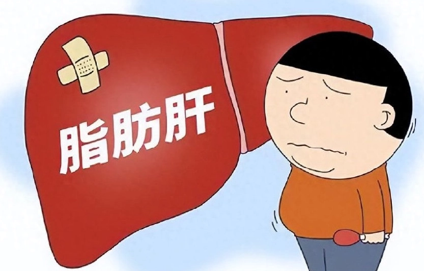 脂肪肝心血管疾病