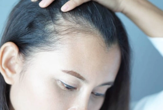 頭髮變細變軟原因
