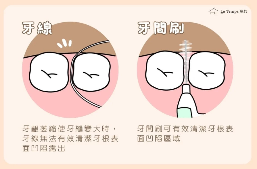 牙線多久用一次 牙線多久用一次
