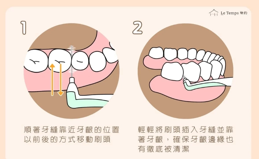 牙縫清潔 牙縫清潔