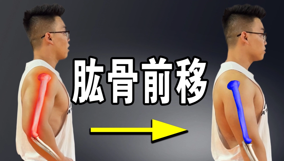 圓肩矯正 圓肩矯正