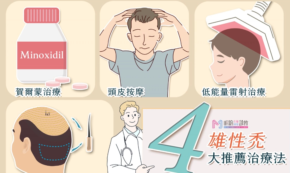 雄性禿治療