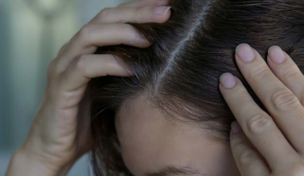 少年白髮預防 少年白髮預防