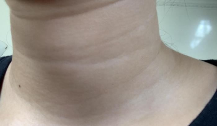 頸部保養 頸部保養