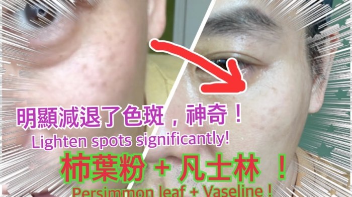 凡士林护肤 凡士林护肤