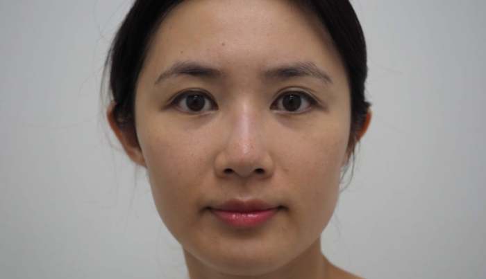 退黑斑方法 退黑斑方法