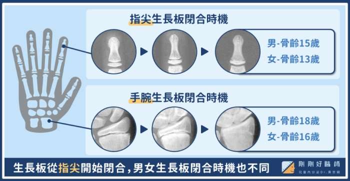 生長板閉合後長高方法