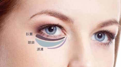 眼袋成因