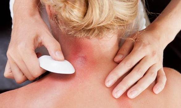 刮痧後飲酒注意事項