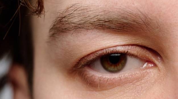 眼瞼下垂改善 眼瞼下垂改善