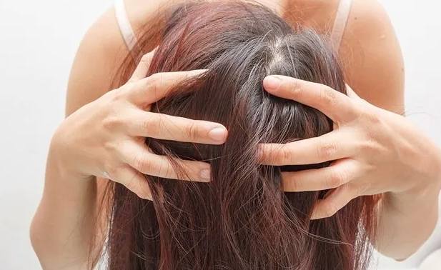 頭皮癢治療 頭皮癢治療