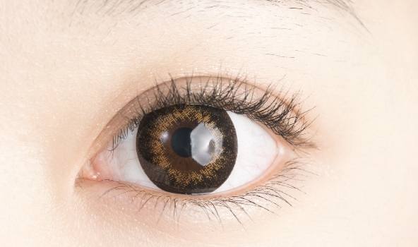 雙眼皮手術恢復