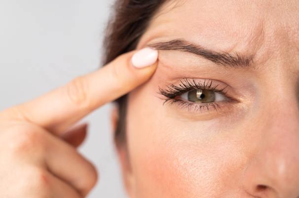 眼瞼下垂改善 眼瞼下垂改善