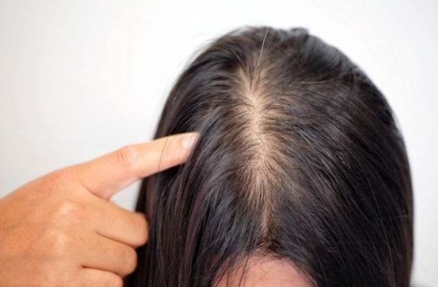 頭頂頭髮生長