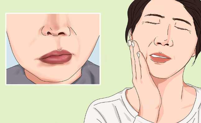 臉麻麻的看什麼科