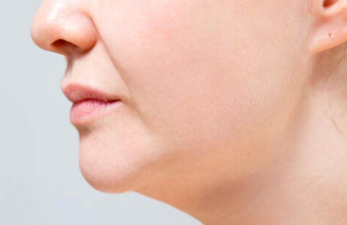 下顎線模糊成因