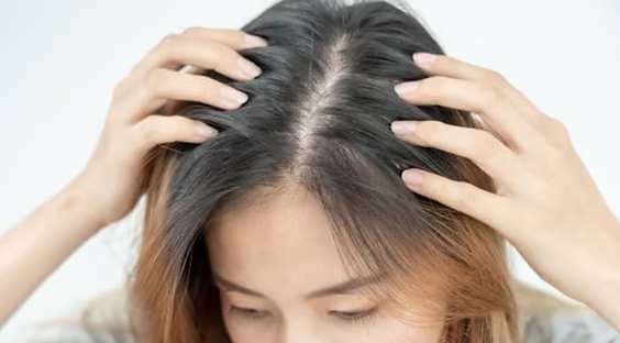 頭頂稀疏原因