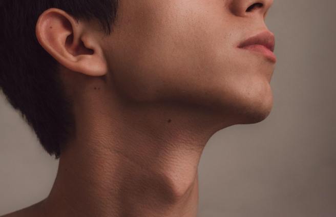 下顎線模糊成因