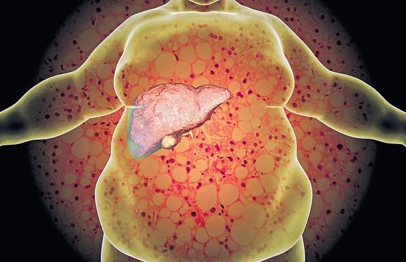 脂肪肝自然療法 脂肪肝自然療法