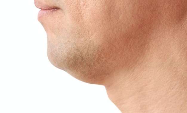 臉部輪廓不明顯