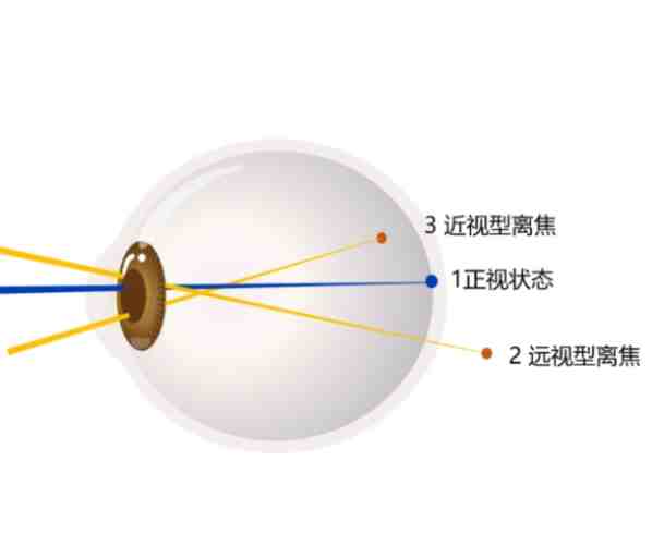 眼睛焦距訓練 眼睛焦距訓練