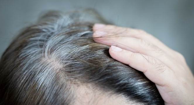 少年白髮預防 少年白髮預防