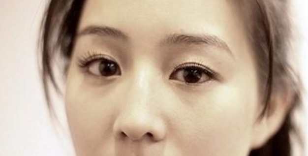 眼睛大小眼治療