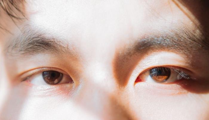 眼睛大小眼治療