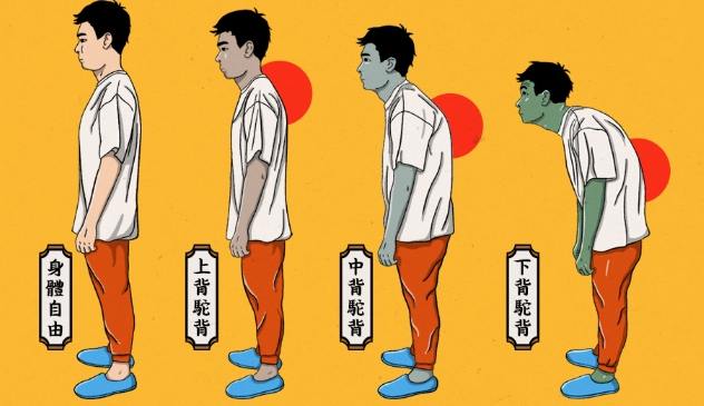 駝背危害 駝背危害