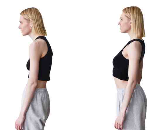 圓肩矯正運動 圓肩矯正運動