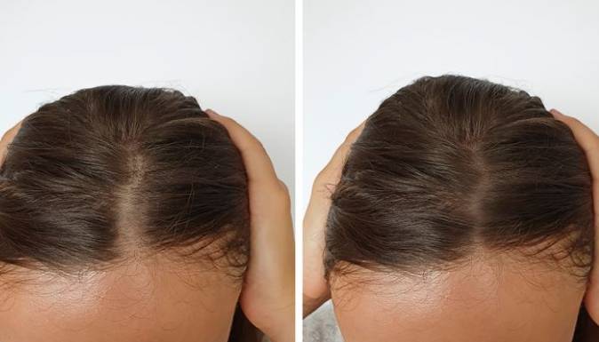 如何加快頭髮生長速度