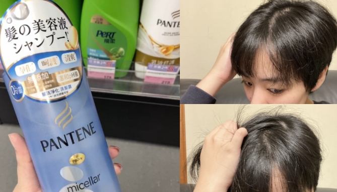 頭皮太乾頭皮屑洗髮精