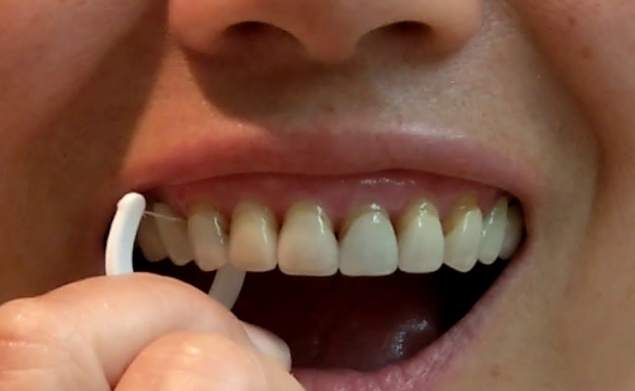 牙线正确用法 牙线正确用法