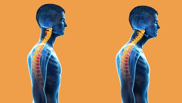 姿勢矯正方法 姿勢矯正方法