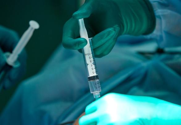 全身麻醉多久會醒