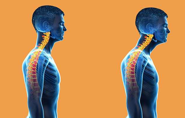 如何矯正烏龜頸？