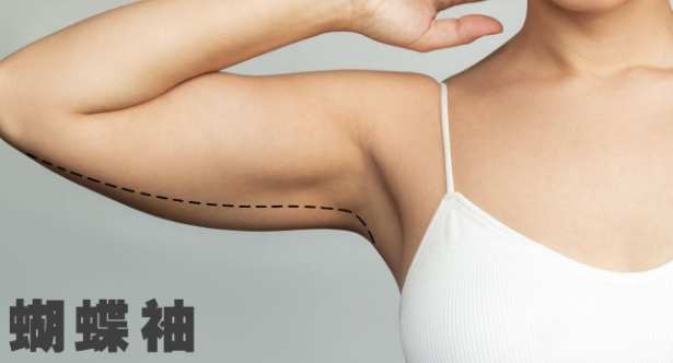 蝴蝶袖鍛鍊 蝴蝶袖鍛鍊