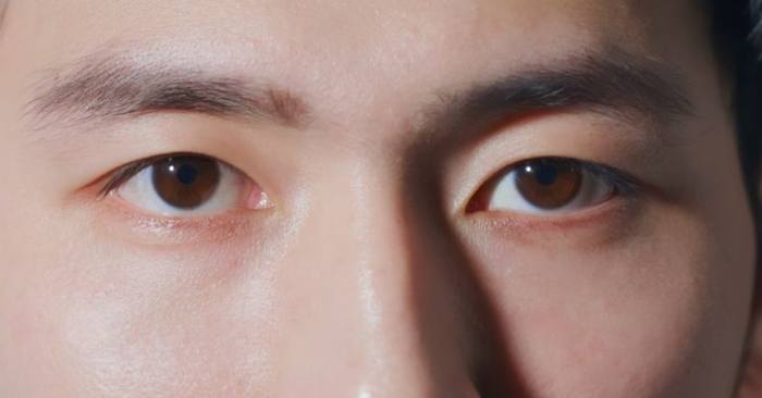 眼睛不對稱怎麼辦