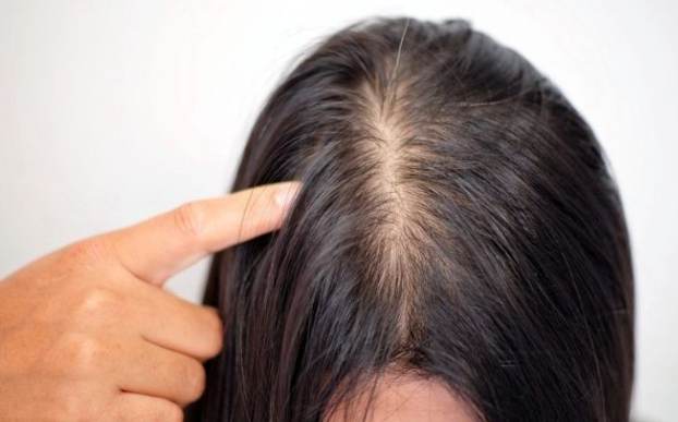 女性掉髮原因 女性掉髮原因