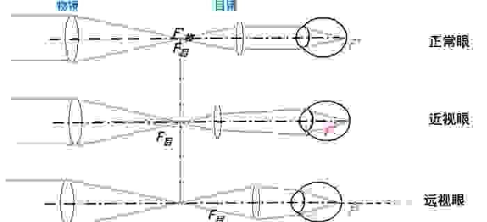 調整眼睛焦距 調整眼睛焦距