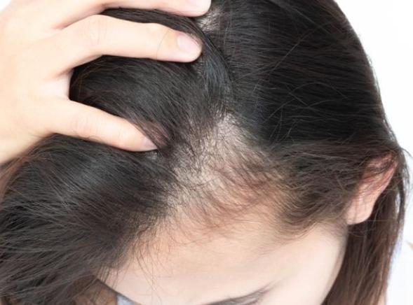 頭髮再生方法
