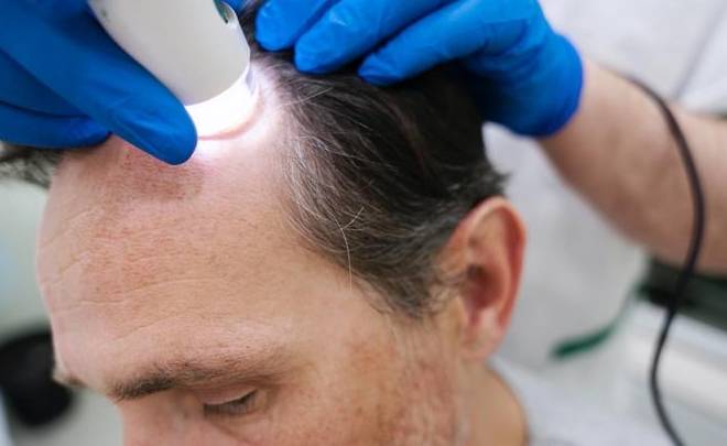 頭頂禿頭改善 頭頂禿頭改善