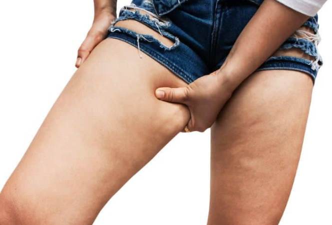 大腿內側瘦身 大腿內側瘦身