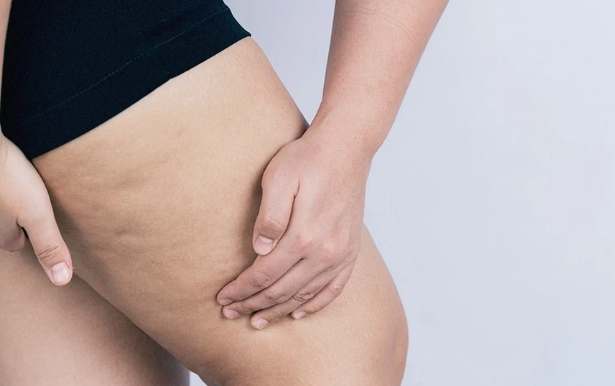 大腿內側瘦身 大腿內側瘦身