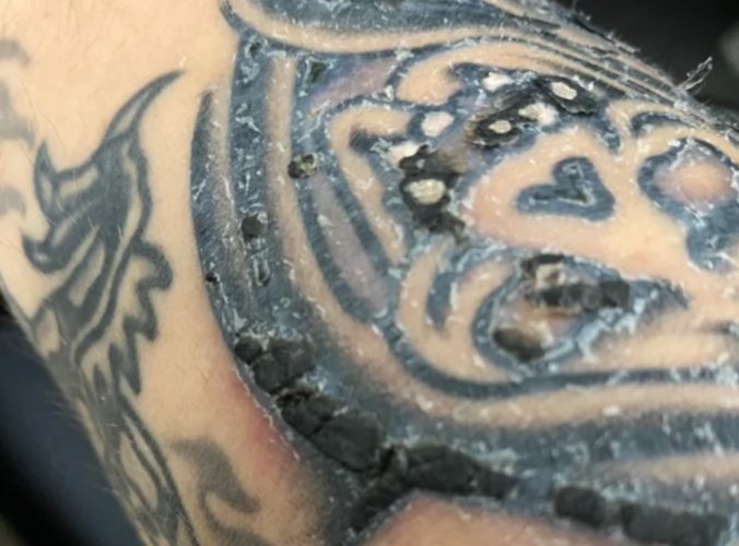 刺青結痂裂開怎麼辦