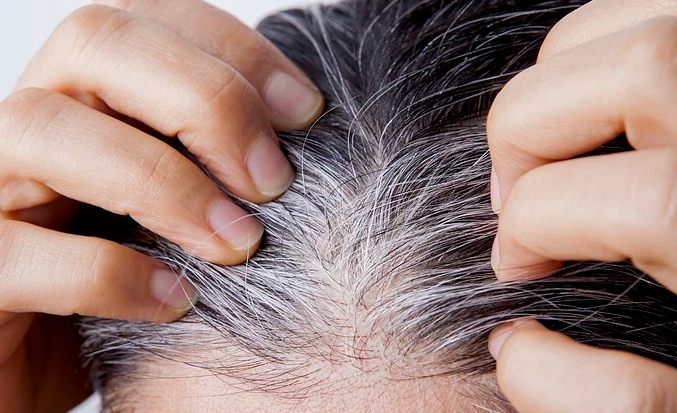 白頭髮吃黑芝麻有效嗎