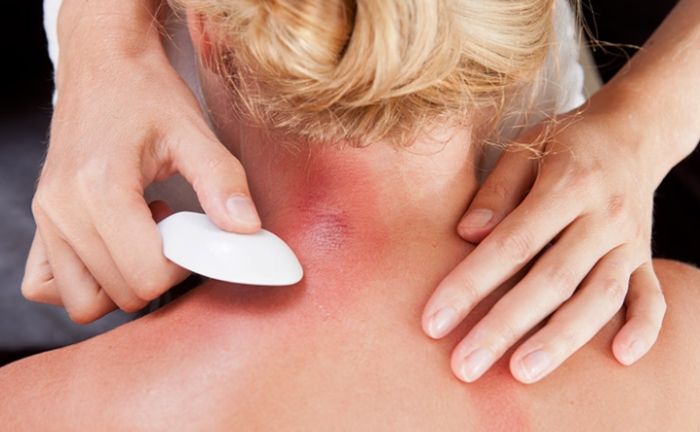 刮痧後可以運動嗎