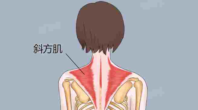 斜方肌酸痛原因 斜方肌酸痛原因
