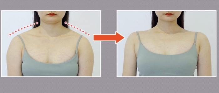 肩頸僵硬改善 肩頸僵硬改善