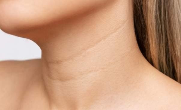 頸部保養 頸部保養